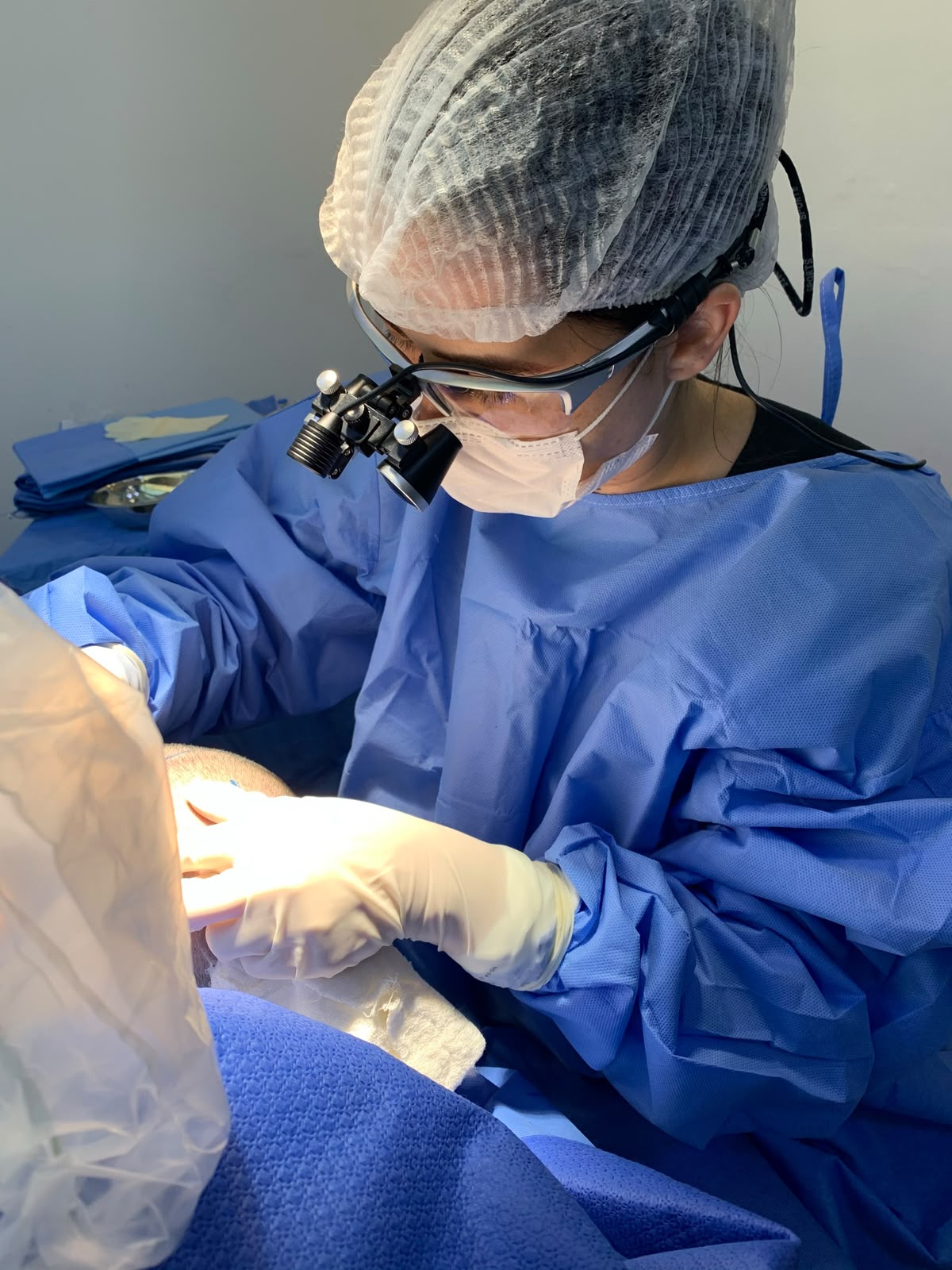 Dra. Taiane Terra realizando cirurgia de transplante capilar com aumento óptico
